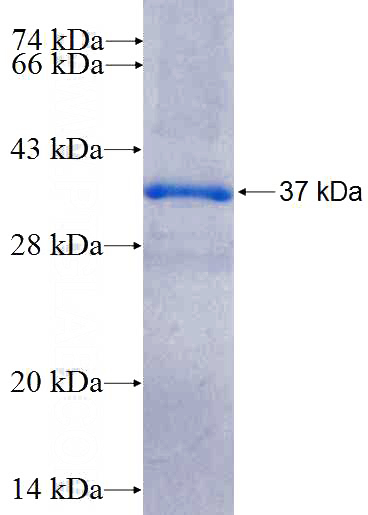 Recombinant Human MKP-2 SDS-PAGE