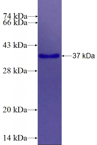 Recombinant Human ANK3 SDS-PAGE