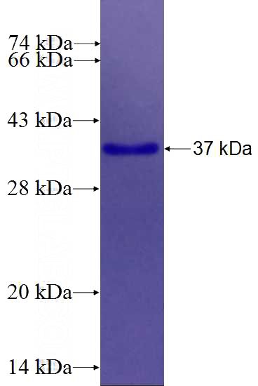Human ANK3 Recombinant protein (6*His tag)