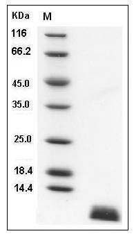 Human Uteroglobin / SCGB1A1 Protein (His Tag) SDS-PAGE