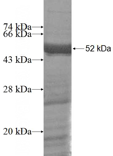 Recombinant Human RUFY2 SDS-PAGE