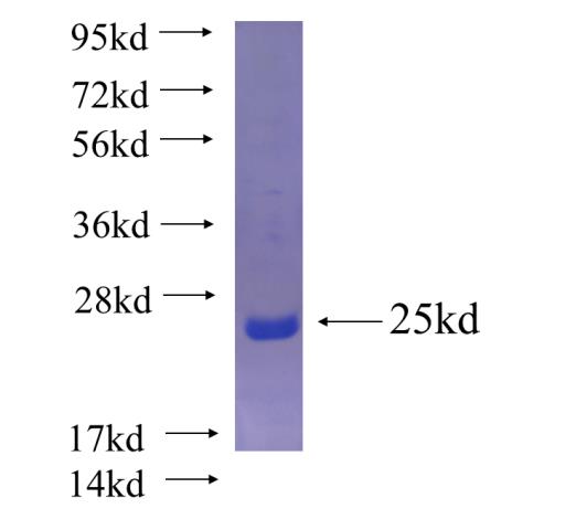 Recombinant human EHHADH SDS-PAGE