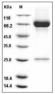 Human MMP8 / CLG1 Protein (His Tag) SDS-PAGE