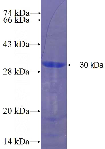 Recombinant Human ZNF165 SDS-PAGE