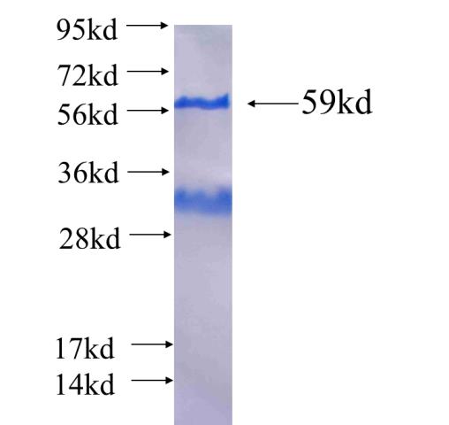Recombinant human RPGRIP1 SDS-PAGE