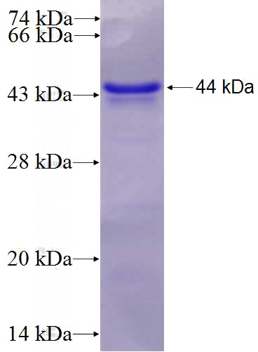 Recombinant Human CUL7 SDS-PAGE