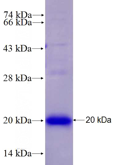 Recombinant Human KPNA3 SDS-PAGE