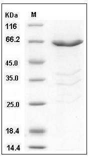 Human PHKG1 Protein (GST Tag) SDS-PAGE