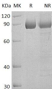 Human SEMA4B/KIAA1745/SEMAC (His tag) recombinant protein
