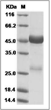 Cynomolgus / Rhesus CCN3 / NOV Protein (His Tag) SDS-PAGE