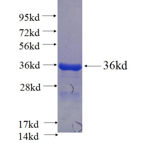 Recombinant human ZNF592 SDS-PAGE