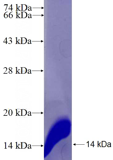 Recombinant Human MARCH9 SDS-PAGE