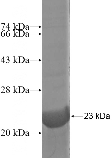 Recombinant Human ANKRD10 SDS-PAGE