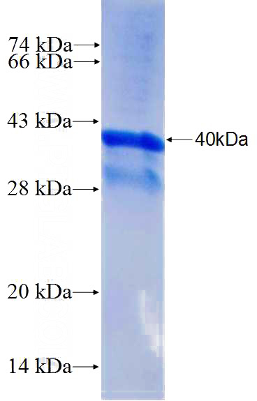Recombinant Human SASH1 SDS-PAGE