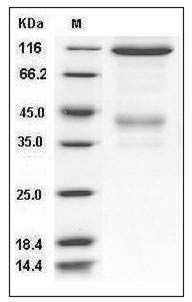 Mouse c-MET / HGFR Protein (Fc Tag) SDS-PAGE
