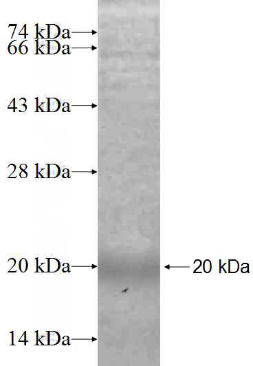 Recombinant Human GPLD1 SDS-PAGE