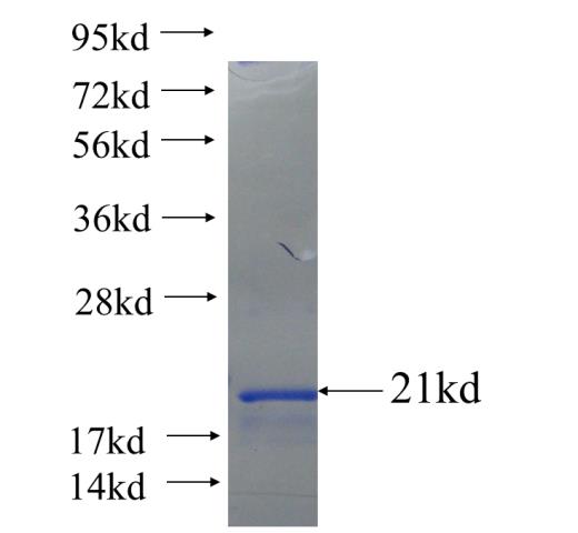 Recombinant human ZNF304 SDS-PAGE