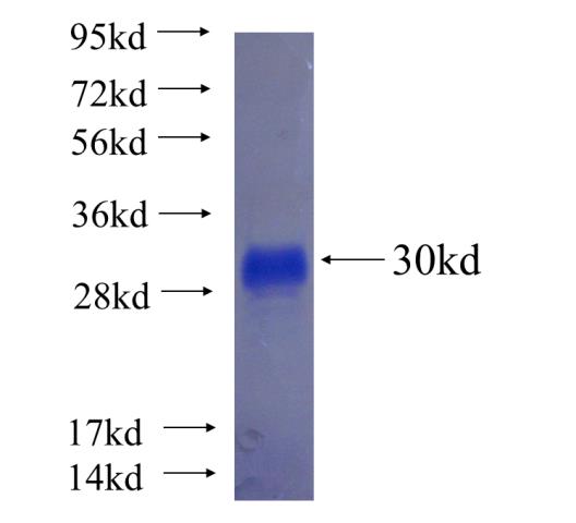 Recombinant human IGFBP1 SDS-PAGE