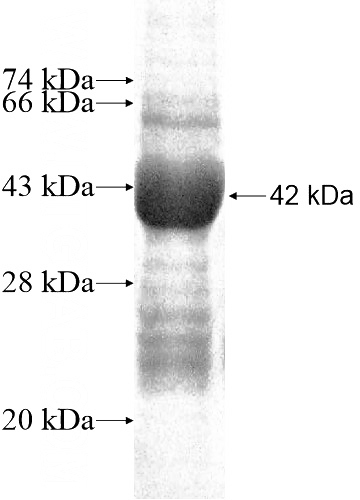 Recombinant Human LCN15 SDS-PAGE
