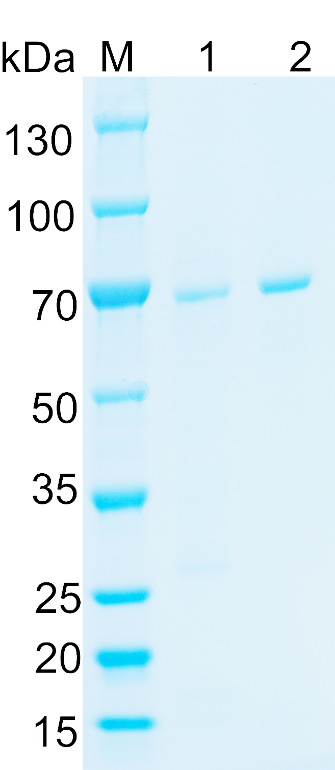Recombinant Human LTBP2 SDS-PAGE