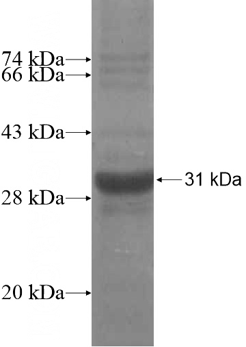Recombinant Human SRCRB4D SDS-PAGE