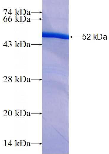 Recombinant Human CCDC124 SDS-PAGE