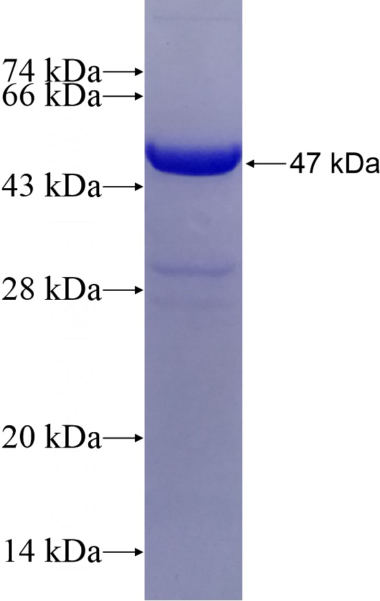 Recombinant Human EIF2AK1 SDS-PAGE