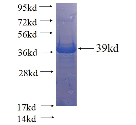 Recombinant human KIAA0841 SDS-PAGE