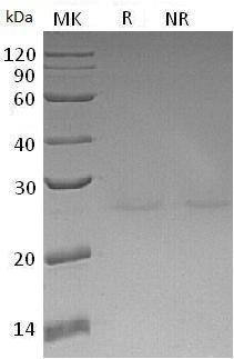 Human PDPN/GP36/PSEC0003/PSEC0025 (His tag) recombinant protein