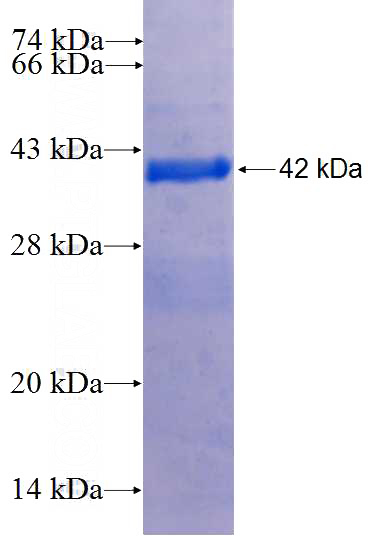 Recombinant Human TCTEX1D2 SDS-PAGE