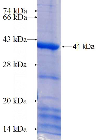 Recombinant Human HSD17B1 SDS-PAGE