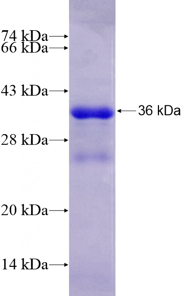 Recombinant Human STAR SDS-PAGE