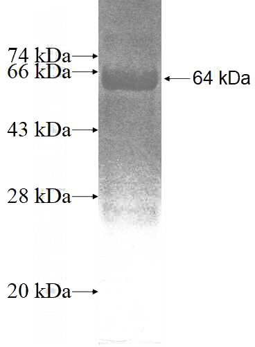 Recombinant Human ZNF24 SDS-PAGE
