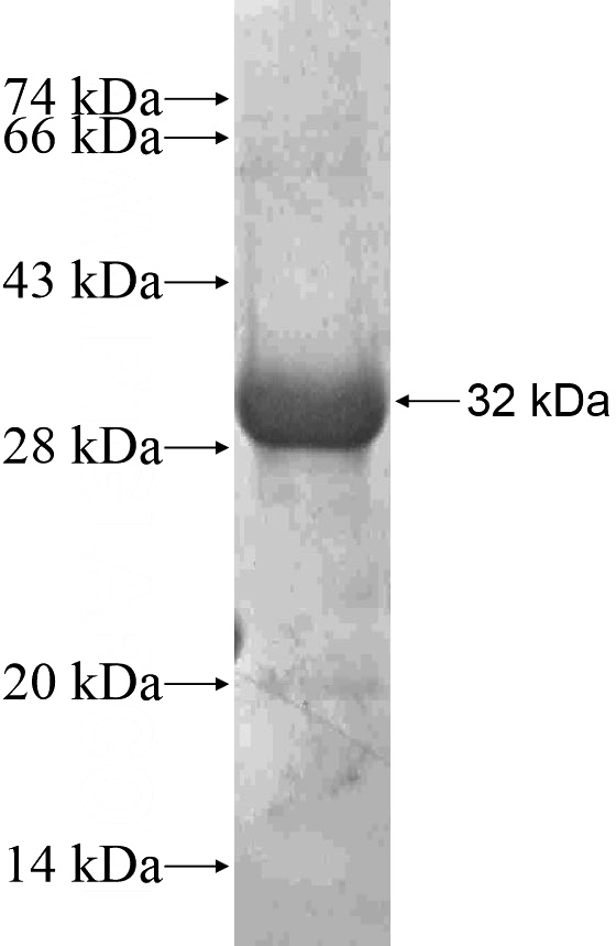 Recombinant Human SYK SDS-PAGE