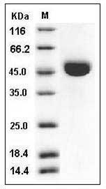Mouse Cathepsin E / CTSE Protein (His Tag) SDS-PAGE