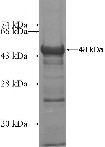 Recombinant Human SNCAIP SDS-PAGE