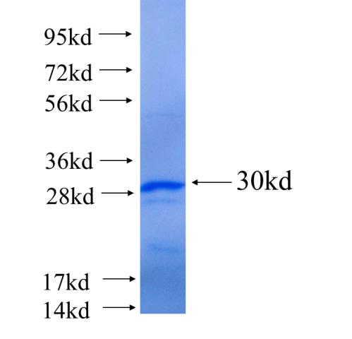 Recombinant human RPL15(Full length) SDS-PAGE