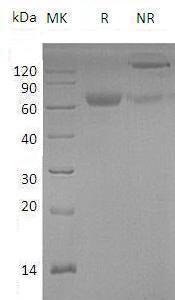 Mouse Angptl4/Farp/Fiaf/Ng27 (Fc tag) recombinant protein