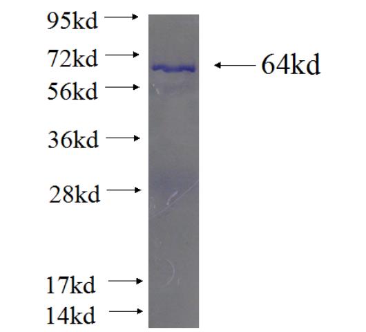 Recombinant human CGN SDS-PAGE