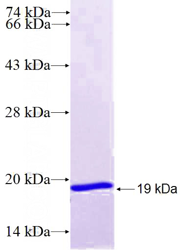 Recombinant Human HAPLN2 SDS-PAGE