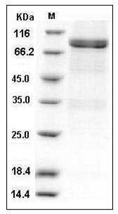 Human Lck Kinase Protein (GST Tag) SDS-PAGE