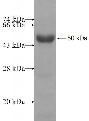 Recombinant Human PCYT2 SDS-PAGE
