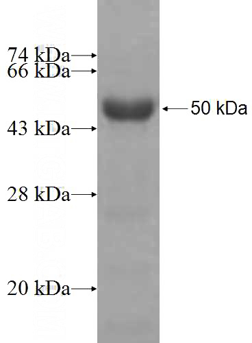 Recombinant Human PCYT2 SDS-PAGE