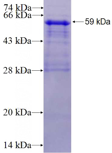 Recombinant Human SERBP1 SDS-PAGE