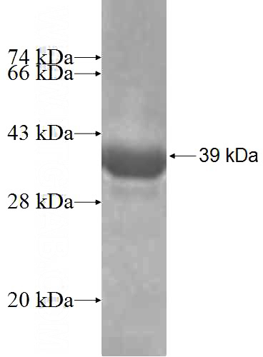 Recombinant Human B3GALTL SDS-PAGE