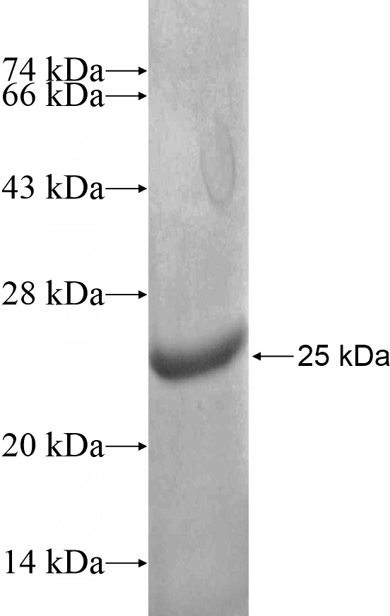 Recombinant Human LGI3 SDS-PAGE