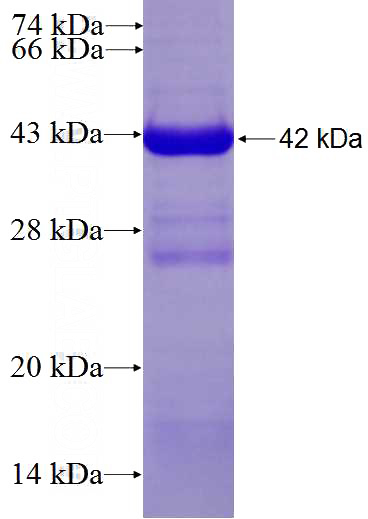 Recombinant Human PCCA SDS-PAGE