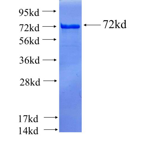 Recombinant human DNMT3A SDS-PAGE