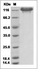 Tek protein SDS-PAGE