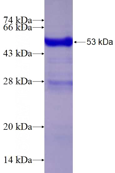 Recombinant Human YEATS4 SDS-PAGE